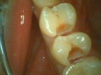 dentalai project thumbnail