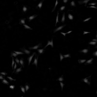 CellBacTracker project thumbnail
