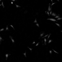 HelaCell project thumbnail
