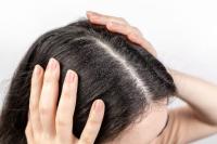 scalp project thumbnail