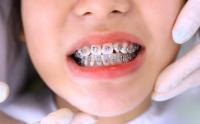 ngoc project thumbnail