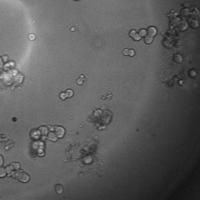 neuron detection project thumbnail
