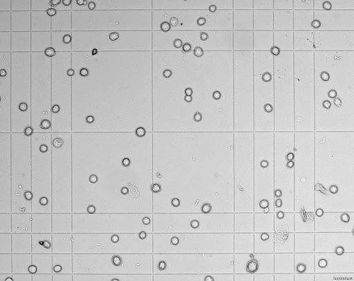 cells Object Detection Model by cells