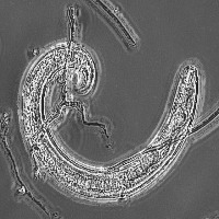 Nematodes Video project thumbnail
