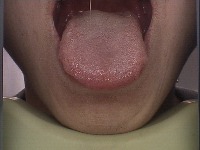 tongue-diagnosis project thumbnail