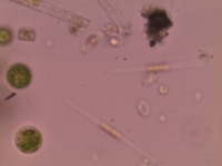 Coleastrum+Hamatococcus project thumbnail
