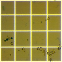 TCC - Cell Identify/Count project thumbnail