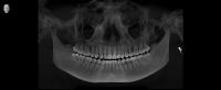dental-part-1 project thumbnail