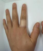 hand-bandage project thumbnail