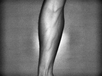 armVein project thumbnail