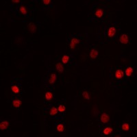 RGC Counts Object Detection Model by Automated Retinal Ganglion Cell ...
