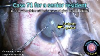 S_CC_2287_case 71 snr resident project thumbnail