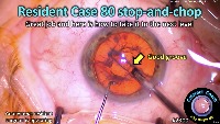 S_CC_2300_resident case 80  project thumbnail