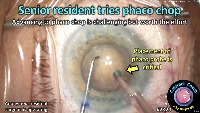 S_CC_2329_senior resident tries  project thumbnail