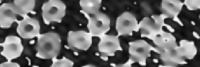 Cell Counting project thumbnail