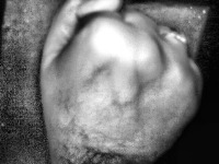 Detection des veines test 1 project thumbnail