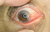 pterygium copy project thumbnail