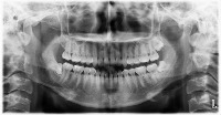 dental project thumbnail