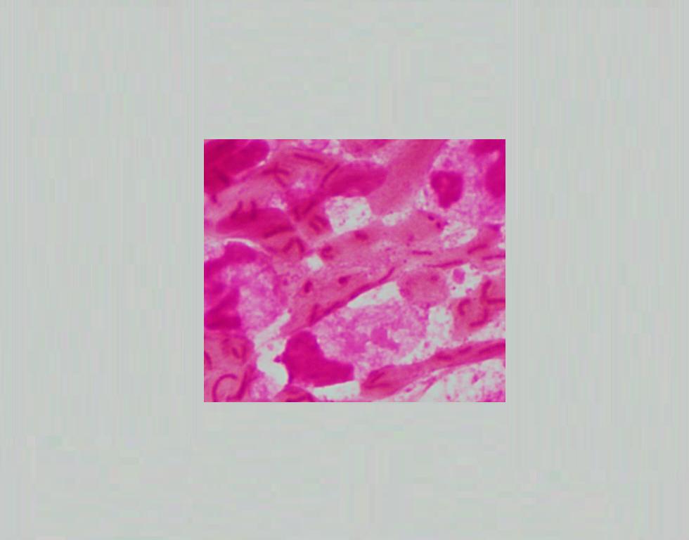 Mucoyd mucoid strain -Ps Object Detection Dataset by Yeast