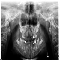 dental-x-ray-panoramic project thumbnail