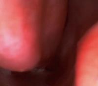 nasal_cavity_nav project thumbnail