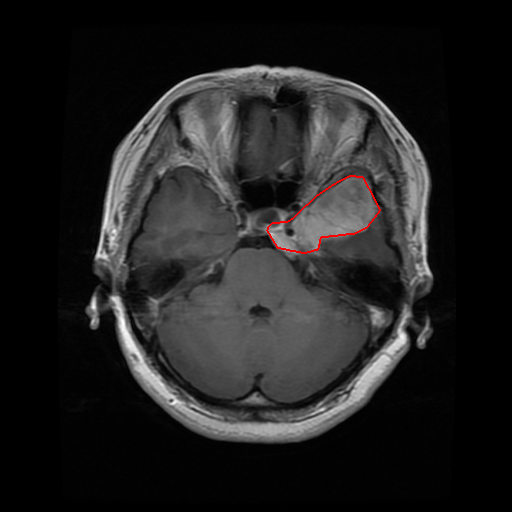 Brain Extration Figshare Brain Extraction Semantic Segmentation Dataset by Figshare