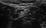 Tibial project thumbnail