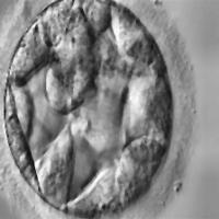 embryo grading project thumbnail