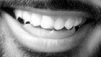 teeth project thumbnail