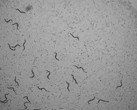 worm detection project thumbnail