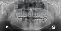 labeling-fkgv2 project thumbnail