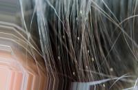 Hair and Scalp DiseasesDetection project thumbnail
