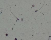 sperm project thumbnail