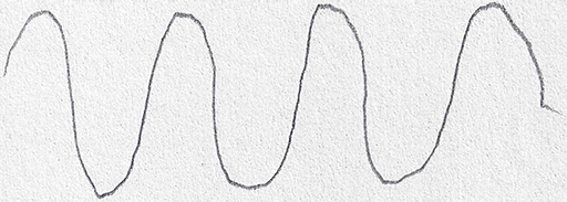 Parkinson_Drawing Classification Dataset and Pre-Trained Model by ...