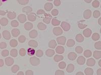 malaria_for_test project thumbnail