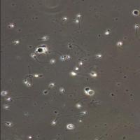 sperm_motality project thumbnail