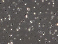 Types_of_Sperm_Cells project thumbnail