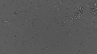 sperm_segmentation project thumbnail