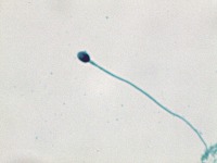 sperma project thumbnail