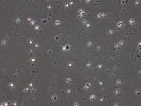 Sperm Segmentation project thumbnail