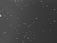Sperm-Motilite project thumbnail