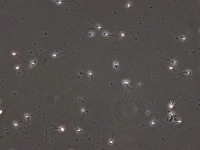 sperm-detection-semantic-segm project thumbnail