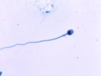 sperm_quality project thumbnail