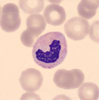 Blood Cell Detection project thumbnail