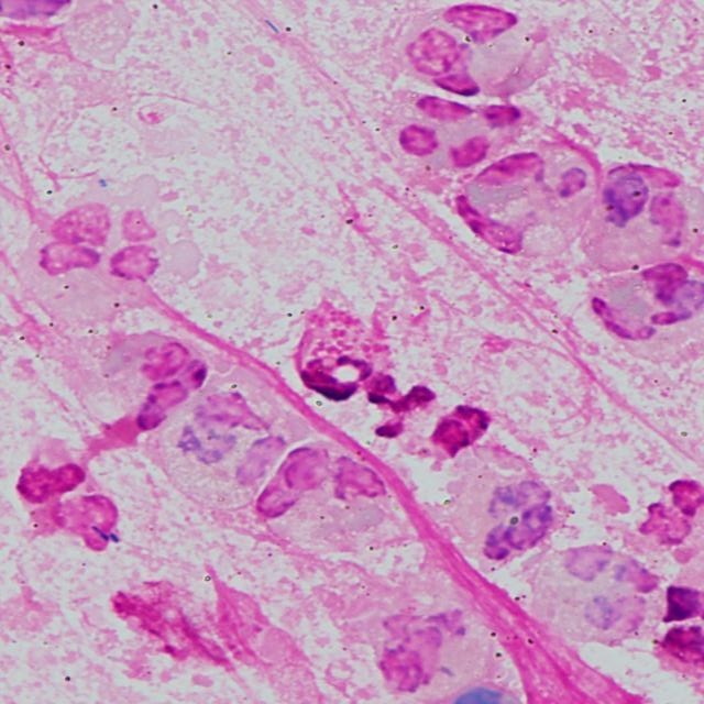 leuko312_2c_4xr Object Detection Dataset by Leukocyte20241020