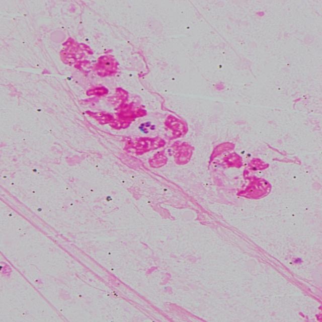 Leuko Insect leuko_3c_8x Object Detection Dataset by Leukocyte20241020