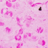 Campylobacter project thumbnail