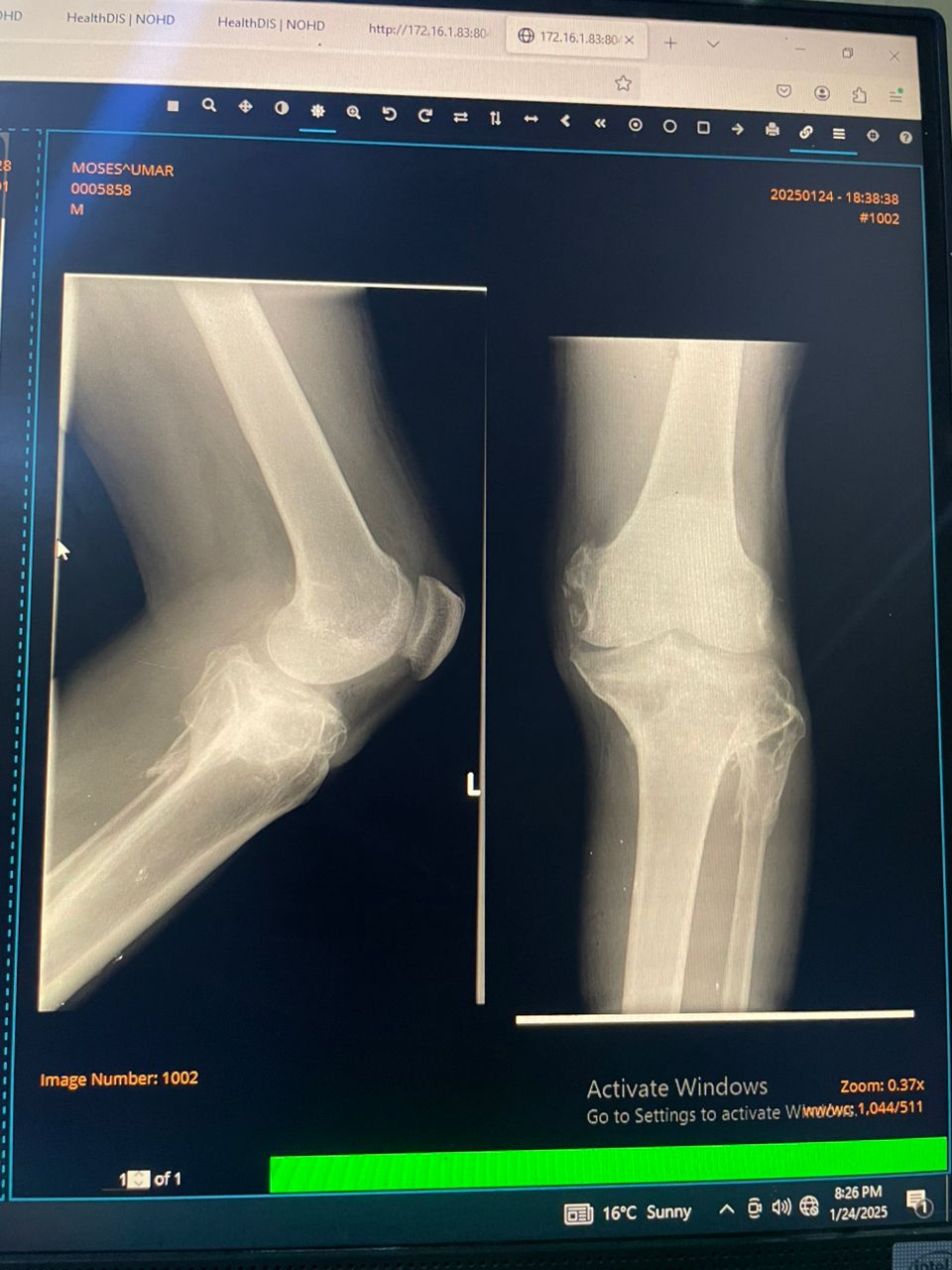 Knee radiographs Keypoint Detection Dataset by Olusegun Oyagbesan