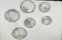 mask detection project thumbnail