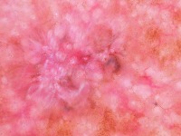 Skin-diseases-dataset project thumbnail